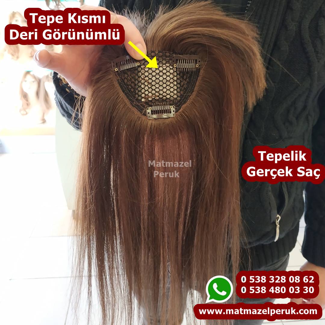 tepelik istanbul